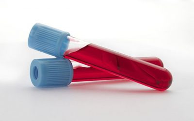 FDA: Blood lead tests may have been inaccurate